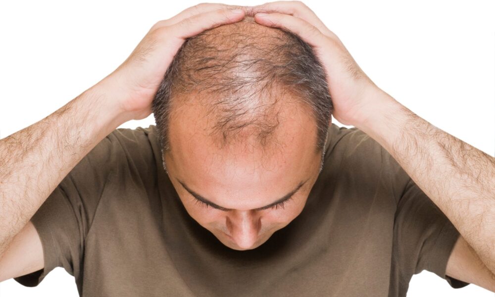 Possible Treatments For Hair Re Growth